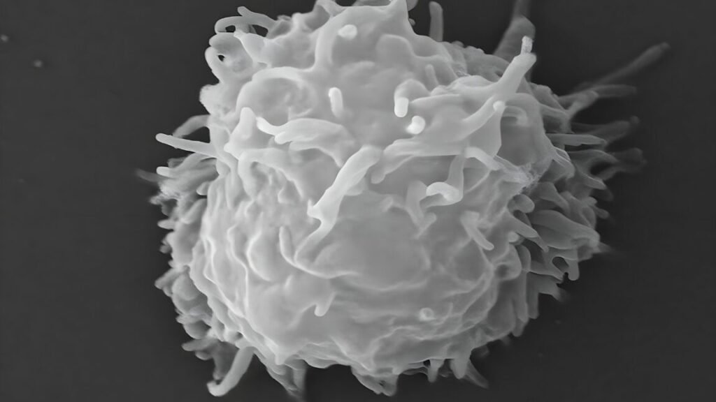 Amoebas eat man alive over months in puzzling, ultra-rare cautionary tale