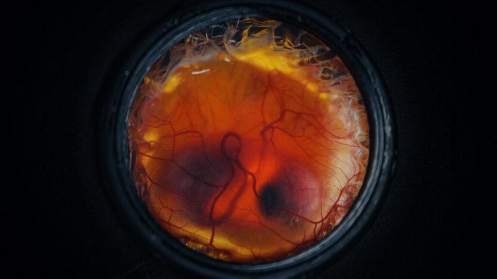a chicken embryo, with visible eyes and beak, surrounded by blood vessels and inside a black metal container.