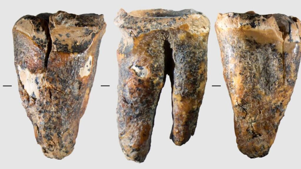 photo of a molar from five sides, showing a large drilled hole in the chewing surface