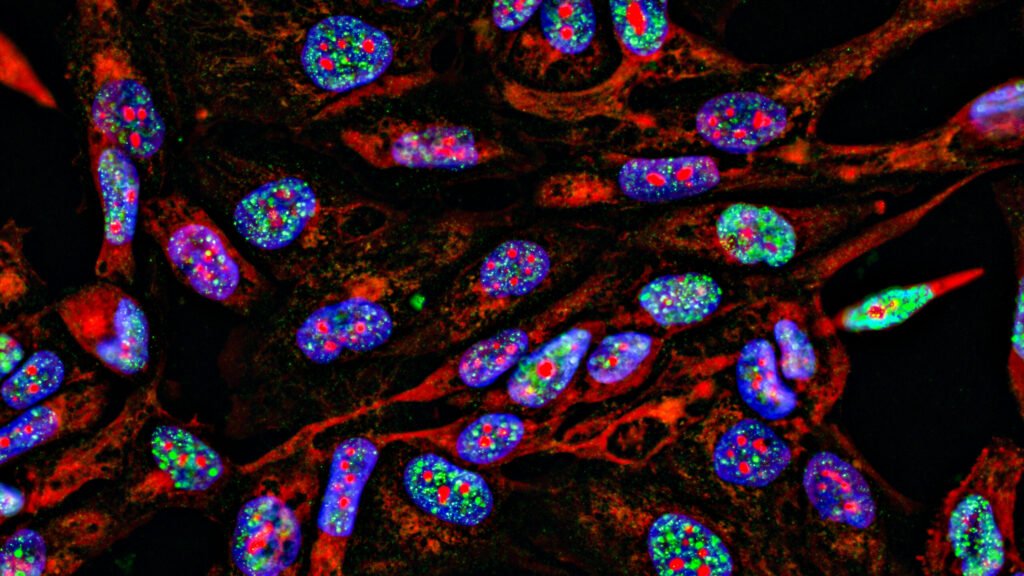 Lab supply companies have been selling antibodies using manipulated images Lab supply companies have been selling antibodies using manipulated images