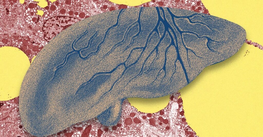There’s a Fatty Liver Epidemic. AI Could Help Get Ahead of It There’s a Fatty Liver Epidemic. AI Could Help Get Ahead of It