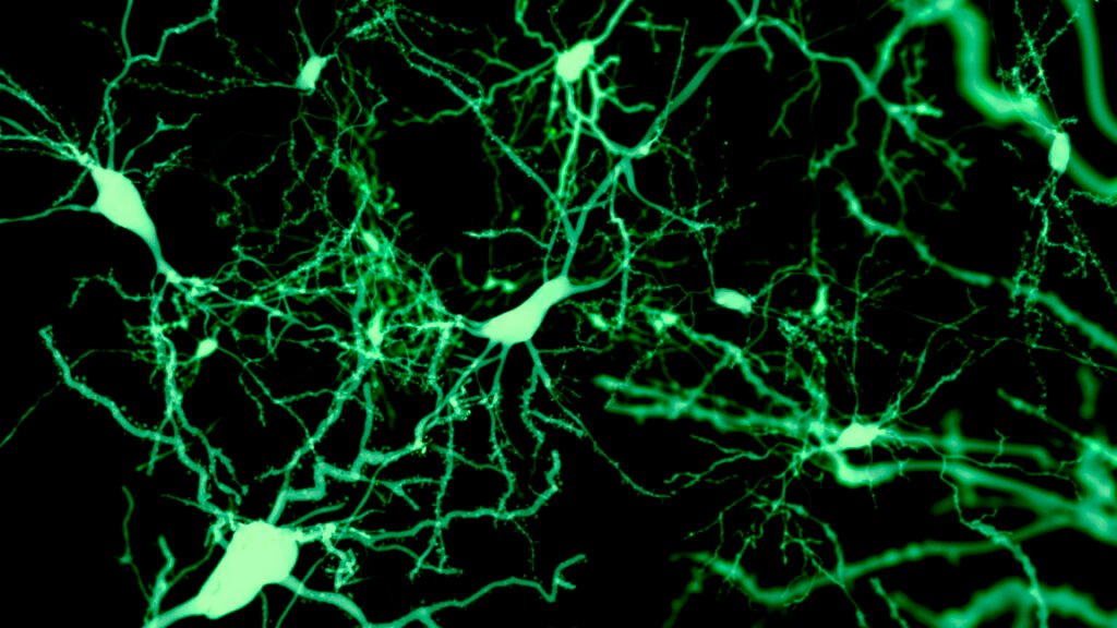 Finding the cells that put our brain to sleep Black background with green fluorescent nerve cells.