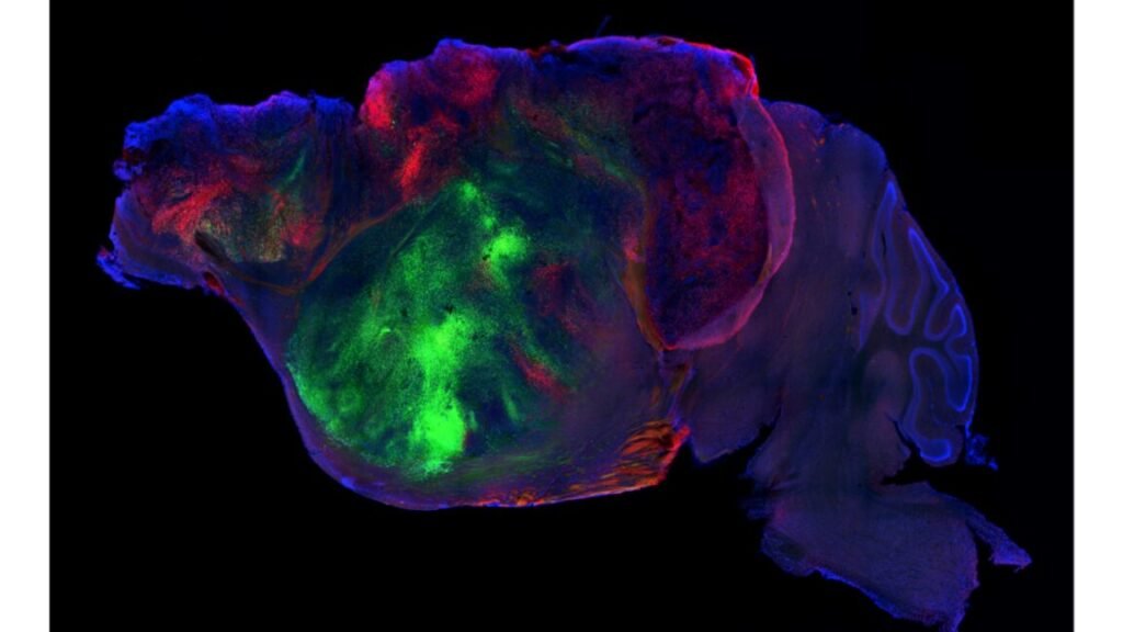 Image of a mouse brain against a black background, light in faint blue and red, with a large patch of intense green in the center.