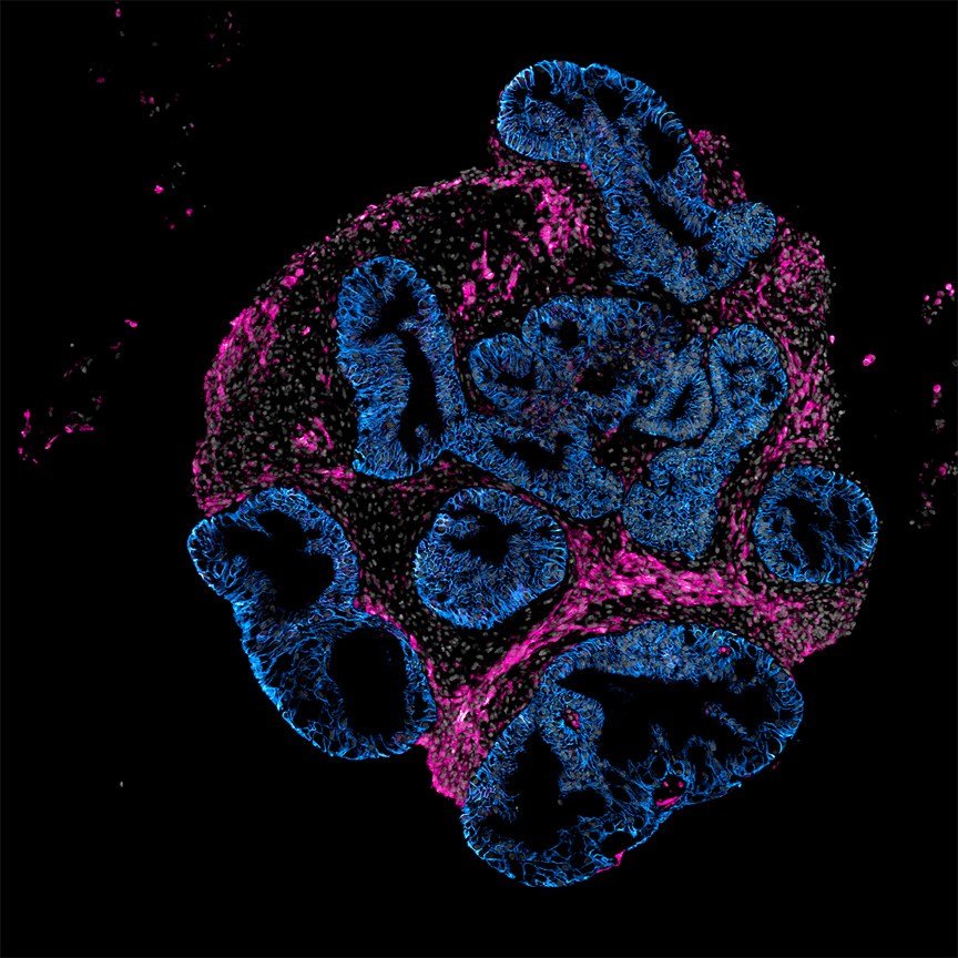 Intero Biosystems wants drugmakers to test on mini human intestines, not animals 2DOrganoidSlice_greynuclei_pinksmoothmuslce_blueepithelium_